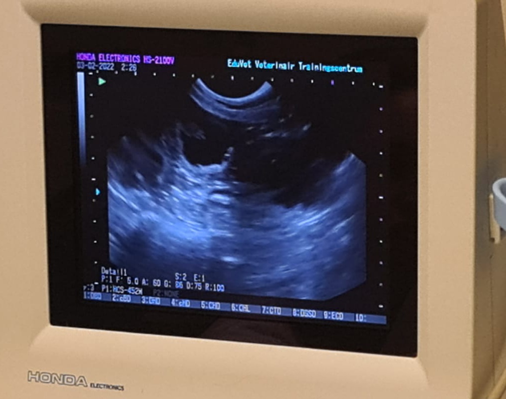 echo bevestiging zwangerschap